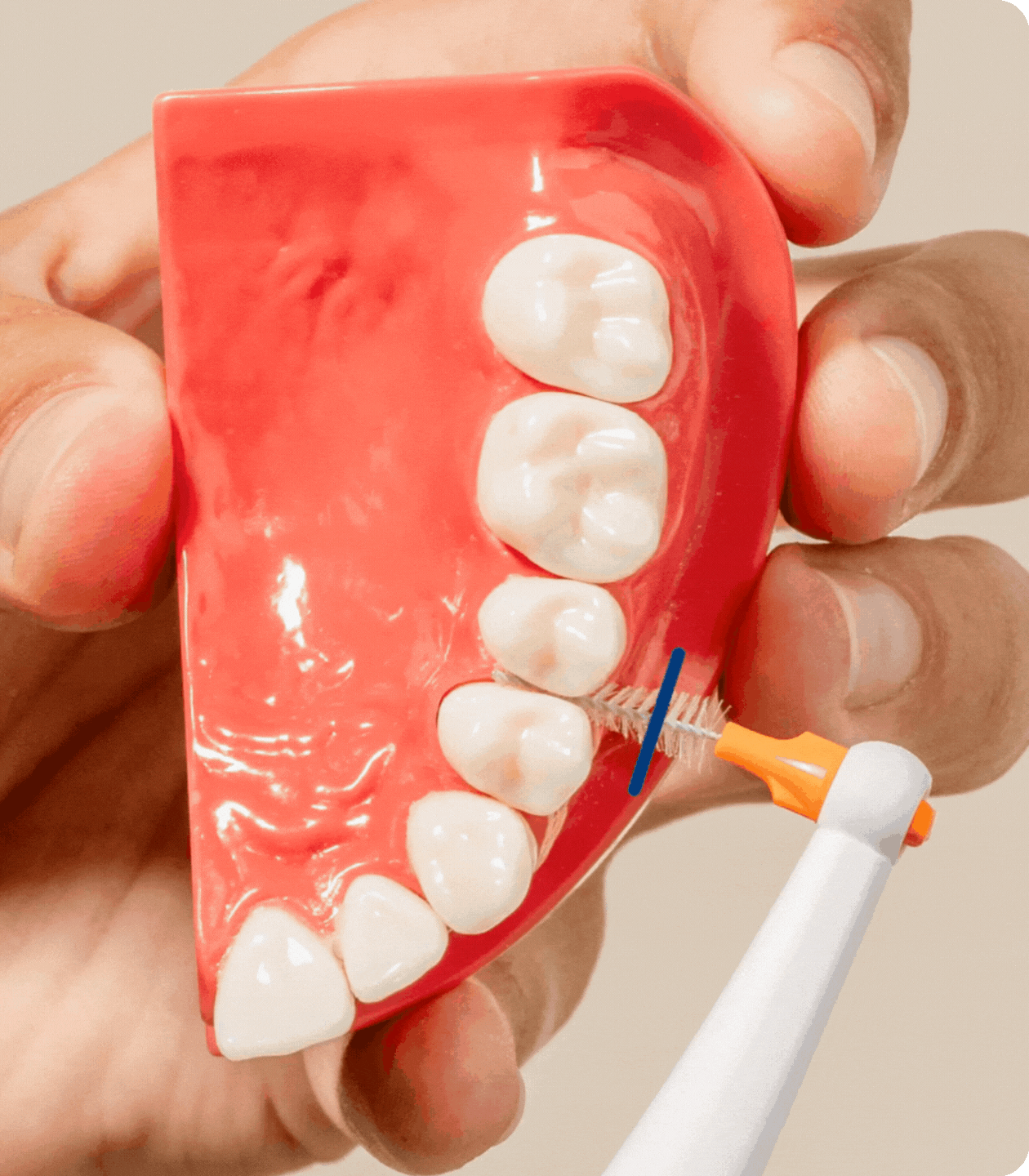 Eriti hoolikas. Ka hammaste vahedes. Hammaste vahelised pinnad moodustavad 30% kogu hammaste pinnast, kuid neid on keeruline puhastada. Tänu meie sonic-hambaharja hambavahefunktsioonile saad lihtsalt ja põhjalikult puhastada 100% su suuõõnest: nii hammaste välispinnad kui ka hambavahed.